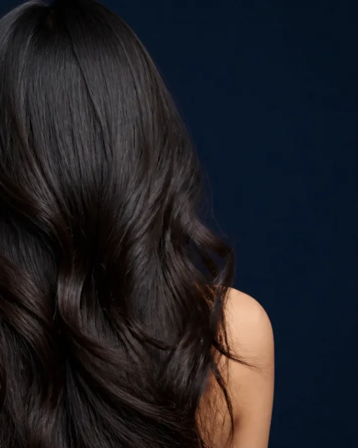 Kadınlarda Saç Ekimi uygulaması — Estetik Hair Antalya